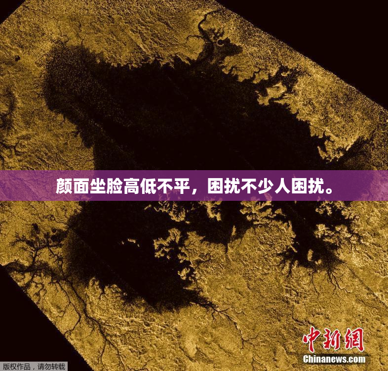 颜面坐脸高低不平，困扰不少人困扰。