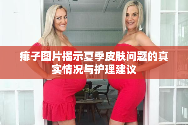 痱子图片揭示夏季皮肤问题的真实情况与护理建议
