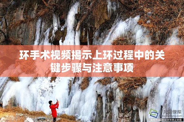 环手术视频揭示上环过程中的关键步骤与注意事项