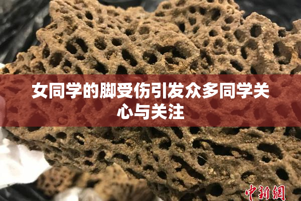 女同学的脚受伤引发众多同学关心与关注