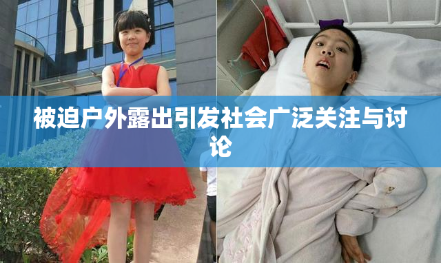 被迫户外露出引发社会广泛关注与讨论