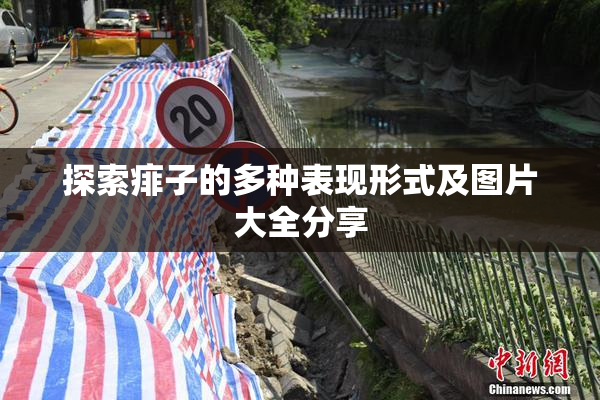 探索痱子的多种表现形式及图片大全分享