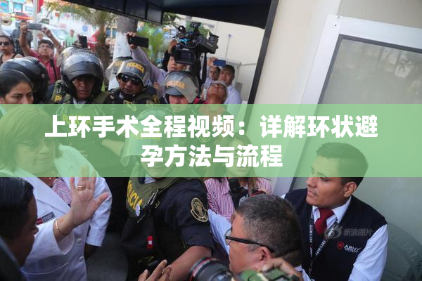 上环手术全程视频：详解环状避孕方法与流程