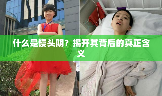 什么是馒头阴？揭开其背后的真正含义