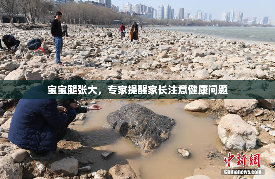 宝宝腿张大，专家提醒家长注意健康问题