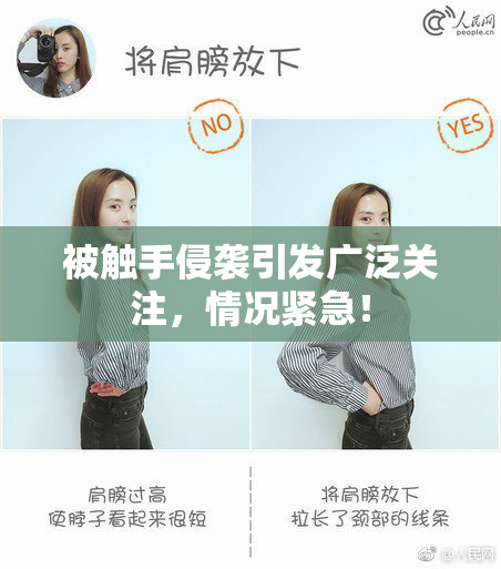 被触手侵袭引发广泛关注，情况紧急！
