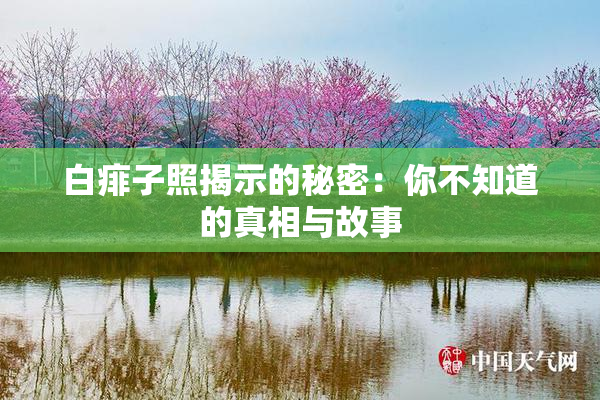 白痱子照揭示的秘密：你不知道的真相与故事