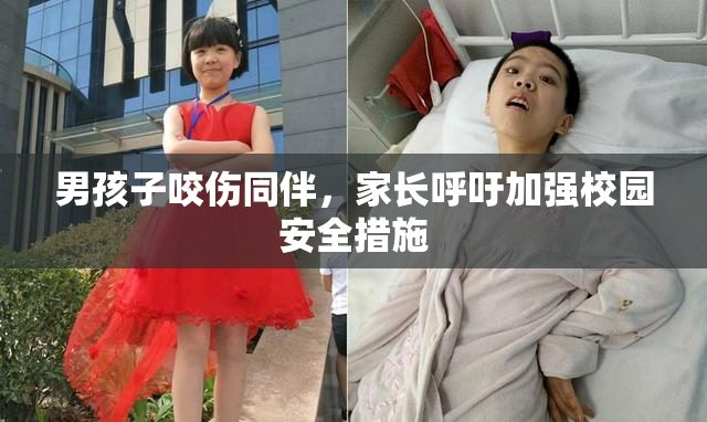 男孩子咬伤同伴，家长呼吁加强校园安全措施