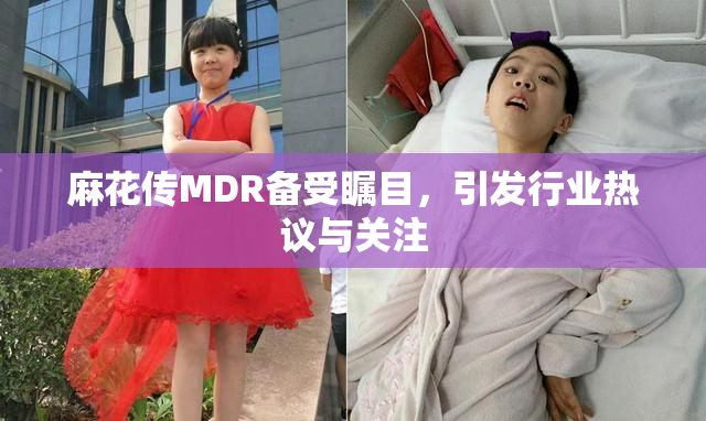 麻花传MDR备受瞩目，引发行业热议与关注