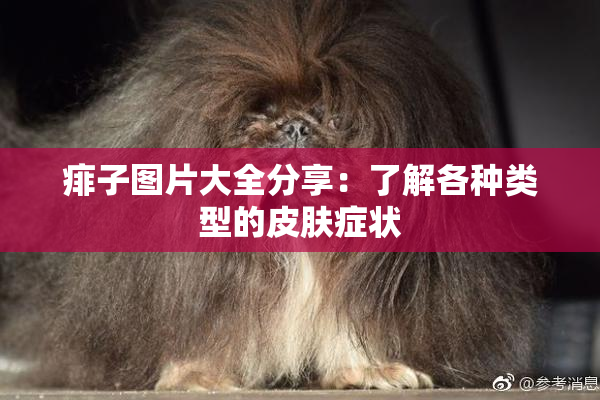 痱子图片大全分享：了解各种类型的皮肤症状