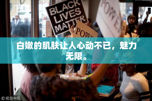 白嫩的肌肤让人心动不已，魅力无限。
